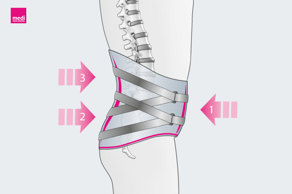 Lumbamed-facet-ILL-function-16to9